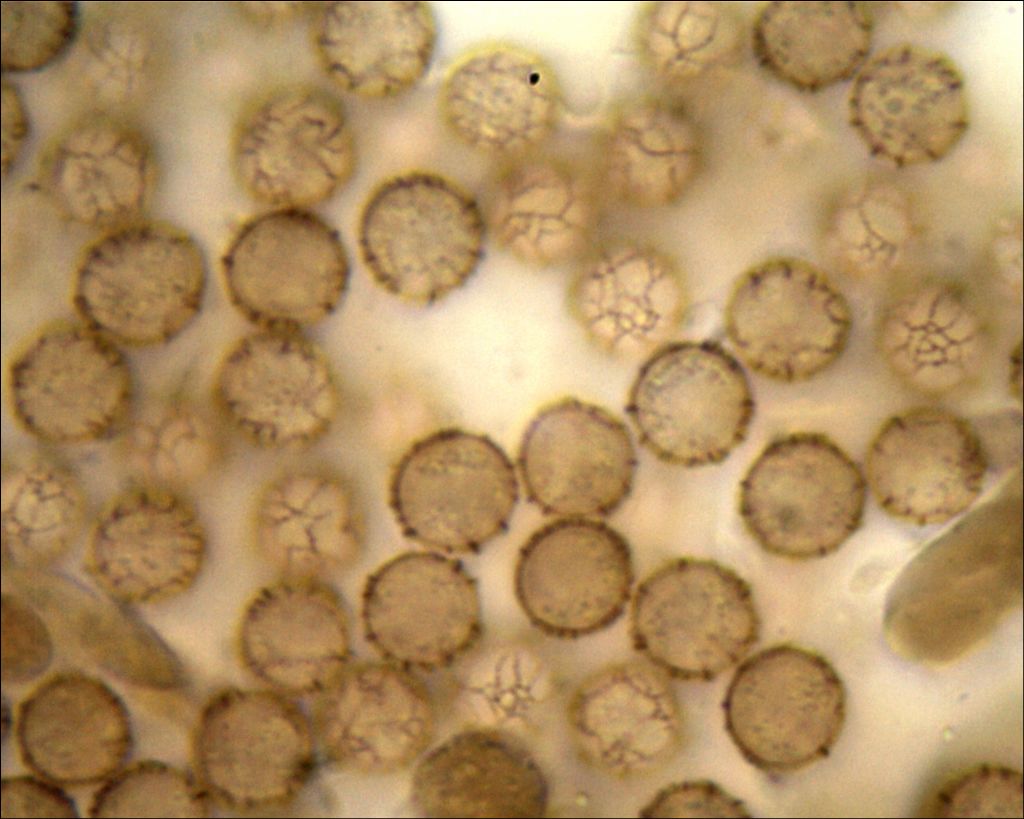 Comatricha o Stemonitopsis?